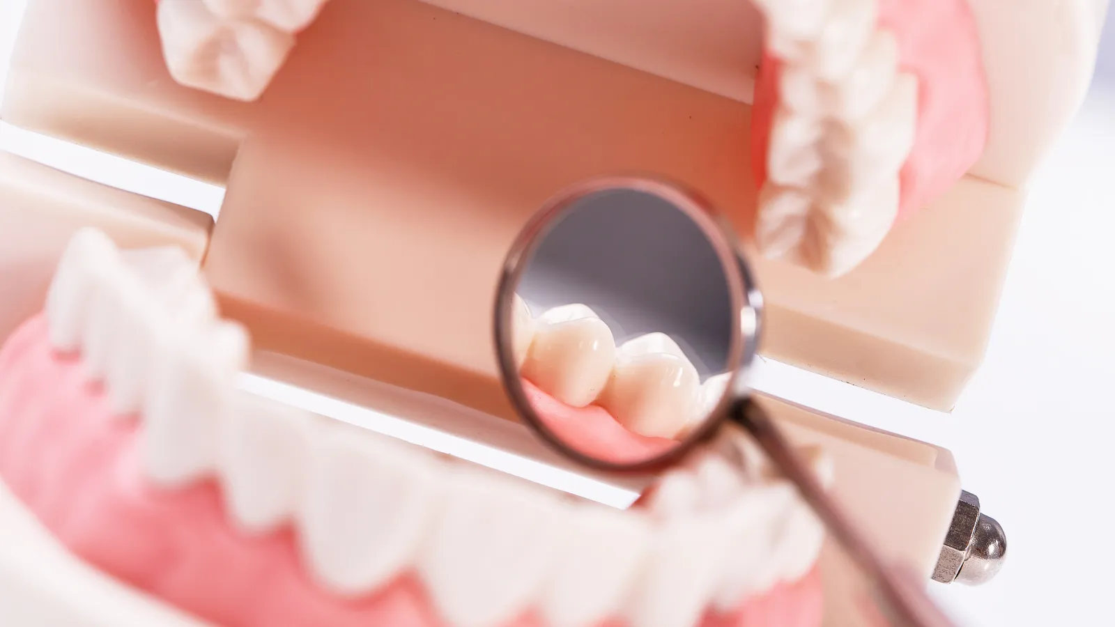 Kesehatan Mulut (Oral) - Bukan Gigi Putih Semata